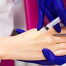 A microinjeção de ácido hialurônico é um dos tratamentos para as mãos