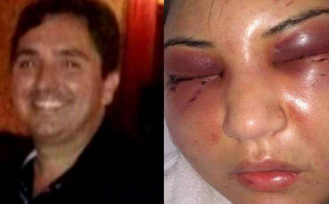 Resultado de imagem para JustiÃ§a manda prender filho de presidente da CÃ¢mara do Rio por agredir mulher