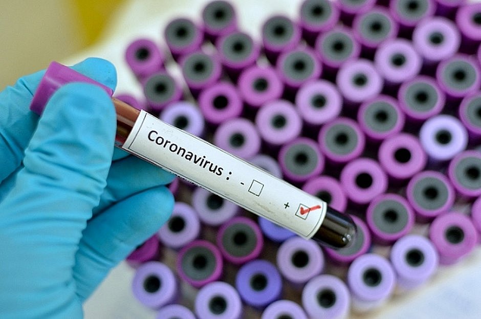 coronavirus.jpg